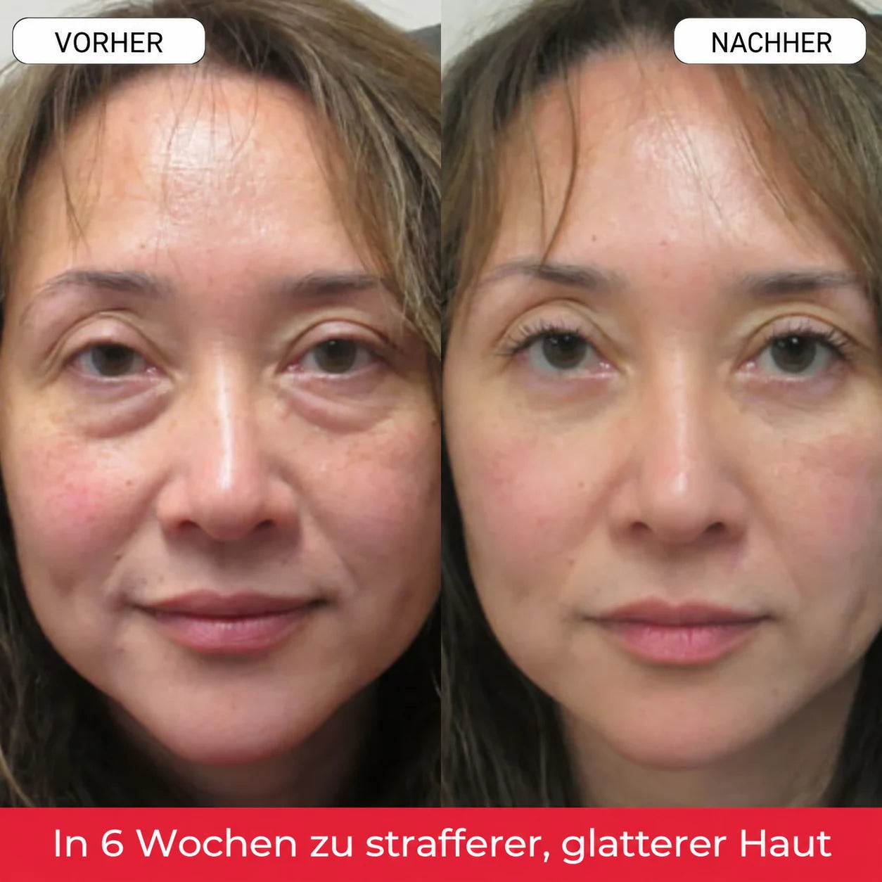 Frau mit natürlicher Hautstruktur